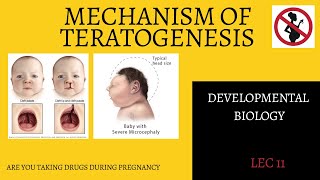 Mechanism of TeratogenesisAbnormal DevelopmentBSMS [upl. by Yssirc]