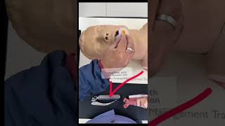 OROPHARYNGEAL AIRWAY INSERTION TECHNIQUE criticalcaremedicine emergencymedicine airwaymanagement [upl. by Valdas99]