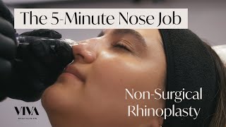 The 5Minute Nose Job 🟡 The NonSurgical Rhinoplasty by VIVA Skin Clinics [upl. by Duong520]