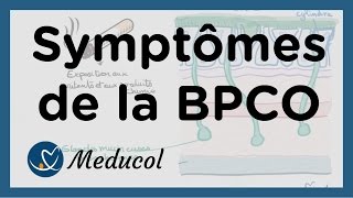 Physiopathologie et symptômes dune bronchite chronique BPCO [upl. by Wesle]