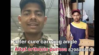 100सही हो गया हैं carrying angle medical test 2023  elbow carrying angle [upl. by Tarabar80]