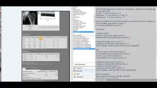 DXA DEXA scan comparing to prior scans and determining significance of BMD change versus LSC [upl. by Ignacia]