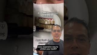 Professional Teeth Whitening vs Hydrogen Peroxide EXPLAINED  In Office to Hands On Dental Training [upl. by Rocca946]