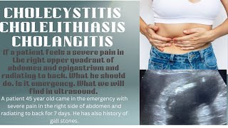 Acute Cholecystitis ultrasound  Acute cholangitis ultrasound  Gallstones ultrasound  cholelithias [upl. by Canada678]