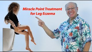 Miracle Point Treatment for Leg Eczema [upl. by Gabriele]