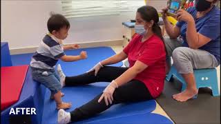 Physical Therapy for Children  Conditions amp Improvements Before amp After Therapy [upl. by Lananna]