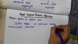 21 23 Pagets disease mp4  ORTHOPEDICS [upl. by Arin]