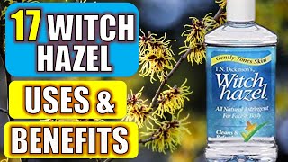 17 Surprising Witch Hazel Benefits amp Uses HEALTH  BEAUTY  CLEANING [upl. by Saberio]