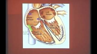 8ECG preexcitation  Dr M Cheniappan [upl. by Codding471]