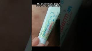 Aziderm 10 cream review how to use azelaic acids cream 10 ww shorts youtubeshorts [upl. by Anytsirhc]