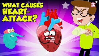 What Causes Heart Attack  How to Keep Your Heart Healthy  Heart Attack Signs and Symptoms [upl. by Peltier]