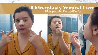 Rhinoplasty Wound Care Dos and Donts After the Operation  Philippines [upl. by Namyl]