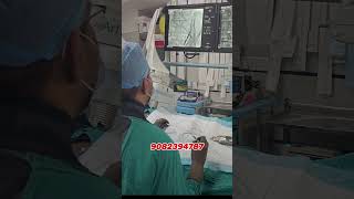 Embolization technique se testis ka Dard kiya durnosurgery minimallyinvasive [upl. by Amatruda]