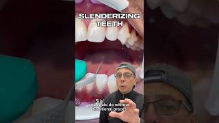 How Invisalign Can Fix Minimal Crowding of Teeth  View Mobile Dental shorts [upl. by Gildea]