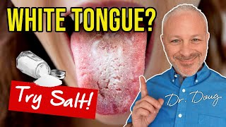 Coated Tongue 👅 Salt Brushing Solution [upl. by Novak]