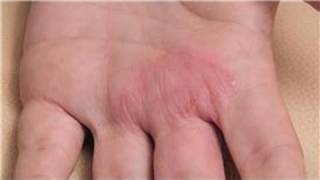 Dermatology Treatments  How to Diagnose Skin Rashes [upl. by Hashum]