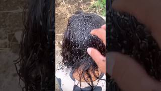 💯Lice amp Nits Treatment At Home  Hair Growth Tips shorts [upl. by Raual236]