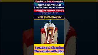 Animated Root Canal l Steps in RCT lDecay tooth l rootcanaltreatment rct [upl. by Radnaxela]