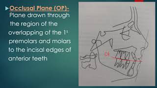 Cephalometric Planes [upl. by Ydissac753]