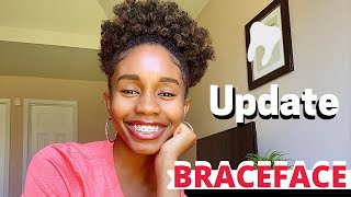 1 MONTH BRACES UPDATE [upl. by Pippy]