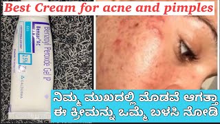 Benzoyl Peroxide Gel 25  Uses Side Effect Full Review In Kannada ಮೊಡವೆಯನ್ನು ಮುಕ್ತ ಗೊಳಿಸುವ ಕ್ರೀಮ್ [upl. by Pierrette]