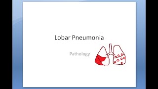 Pathology 465 a Lobar Pneumonia Lung Inflammation Pneumonitis Types Classify Red Hepatization Grey [upl. by Ativoj]