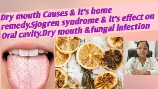 Dry mouth Causes amp its home remedySjogren syndrome amp its effect on Oral cavityDry mouth fungal [upl. by Lindahl609]