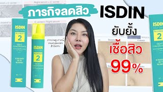 กูรูเช็คภารกิจพิชิตสิวกับ ISDIN ACNIBEN ลดสิว รอยสิว คุมมัน ยับยั้งเชื้อสิวได้ถึง 99 [upl. by Selhorst767]