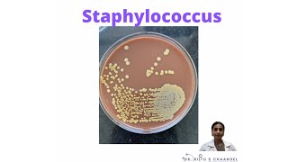 Things to know about Staphylococcus [upl. by Norok905]