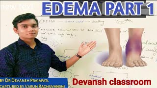 Edema part 1 introduction [upl. by Nwahsear315]