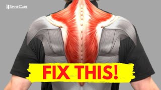 How to Fix Muscle Knots in Your Neck and Shoulder in 30 SECONDS [upl. by Gurl]