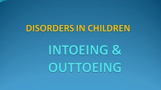 Orthopedics 4 Intoeing Outtoeing in children [upl. by Akeemat]