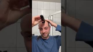 Balding Man Shocked By EPIC Transformation [upl. by Ahsekim]