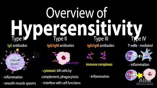 Hypersensitivity Overview of the 4 Types Animation [upl. by Suzetta]