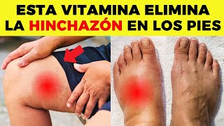 ESTA es LA MEJOR VITAMINA para ELIMINAR la HINCHAZÓN en PIES y PIERNAS [upl. by Kier]