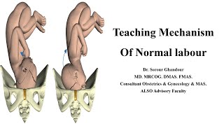 Mechanism of Normal labour  Teaching Station for Part 3 MRCOG [upl. by Ettenel601]