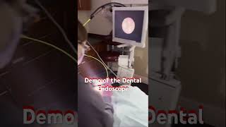 DENTAL EXPERT Shares Top Endoscope Techniques for Perfect NonSurgical Treatment [upl. by Judas39]