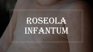 Pediatrics Infectious disease  Roseola infantum exanthem subitum [upl. by Aicyla]