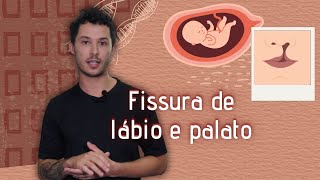 Ambiente embrionário influencia o DNA na fissura labiopalatina  Epigenética 7 [upl. by Jaala]