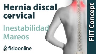 ¿Puede una hernia discal cervical provocar mareos e inestabilidad [upl. by Yleik]