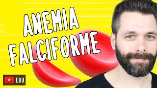 ANEMIA FALCIFORME  Biologia com Samuel Cunha [upl. by Eesyak827]