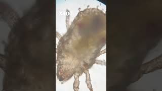 Microscopic Mite music microscope ponds bug evolution life cell tiny microbiology [upl. by Neslund]