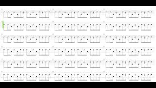 Myxomatosis  Radiohead  Drum only  Drum tab [upl. by Fleeta]