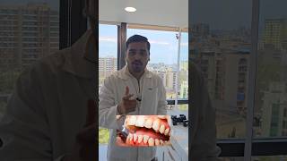 Teeth cleaning  at Dentist in Ulwe teethwhiteningteethcleaning teethplaque teeth [upl. by Highams523]