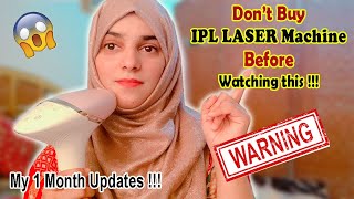 Honest review on IPL Hair Removal Laser  My 1 month Experience [upl. by Kwabena]