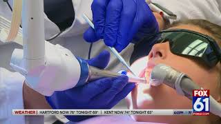 Dr David Fantarella Featured on FOX61 With The Solea Laser [upl. by Ahras]