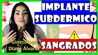 SANGRADOS con IMPLANTE SUBDERMICO ¿Por Qué ¿Qué Hacer por GINECOLOGA DIANA ALVAREZ [upl. by Ruperta]