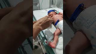 I v cannula insertion New born baby admission NICU care neonatal [upl. by Jaqitsch]