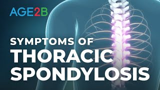 What Are the Symptoms of Thoracic Spondylosis Thoracic MidBack Pain or Disc Spondylolisthesis [upl. by Gerianne]