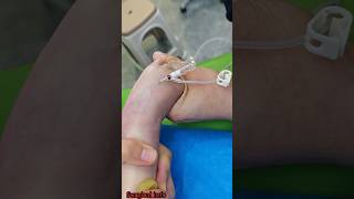 How to insert iv cannula in children song trending shorts [upl. by Flem]